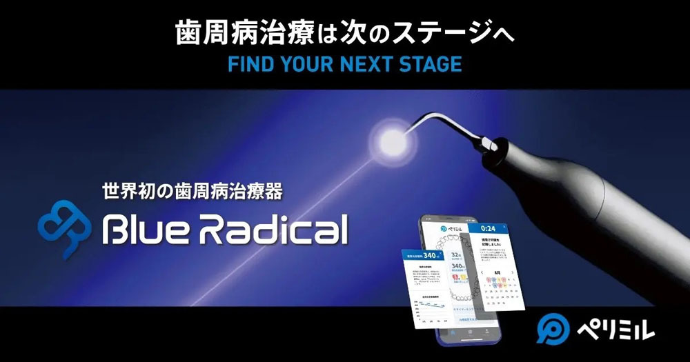 ブルーラジカルとは?歯周病治療の新しい選択肢|効果・費用・従来治療との違いを解説